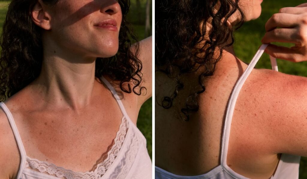 Remove Sun Tan Naturally at Home Easy Remedies for City Skin banner