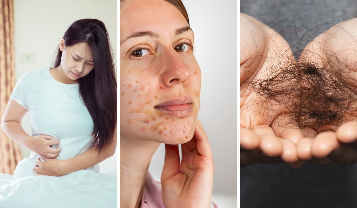 hair gut skin deficiency symptoms